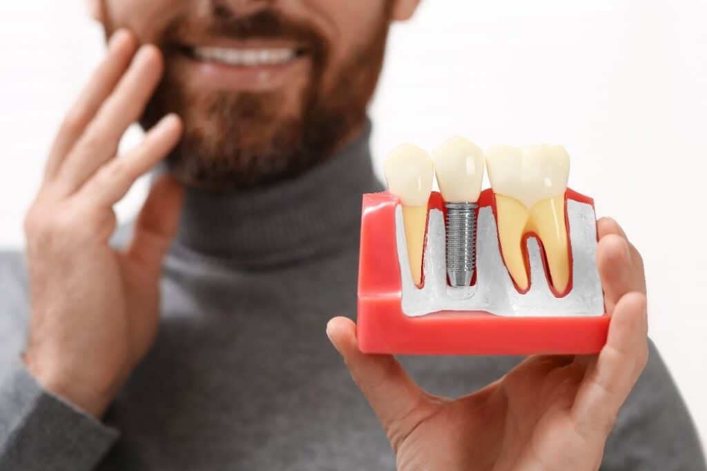 Dental Implants Puyallup